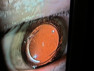 eyeball.JPG